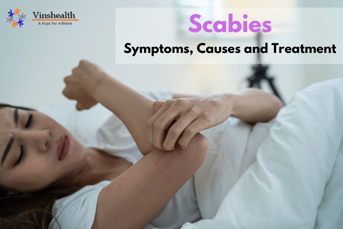 Scabies: Symptoms, Causes and Treatment