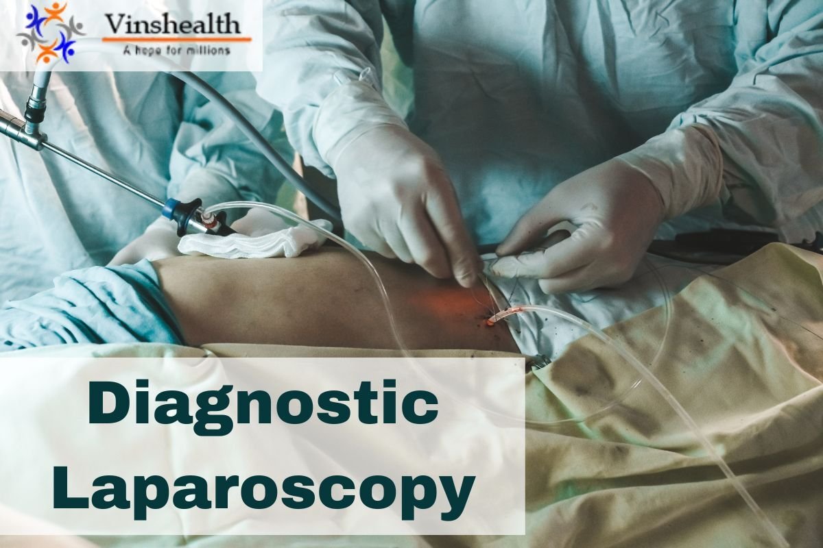 Diagnostic Laparoscopy: keyhole surgery