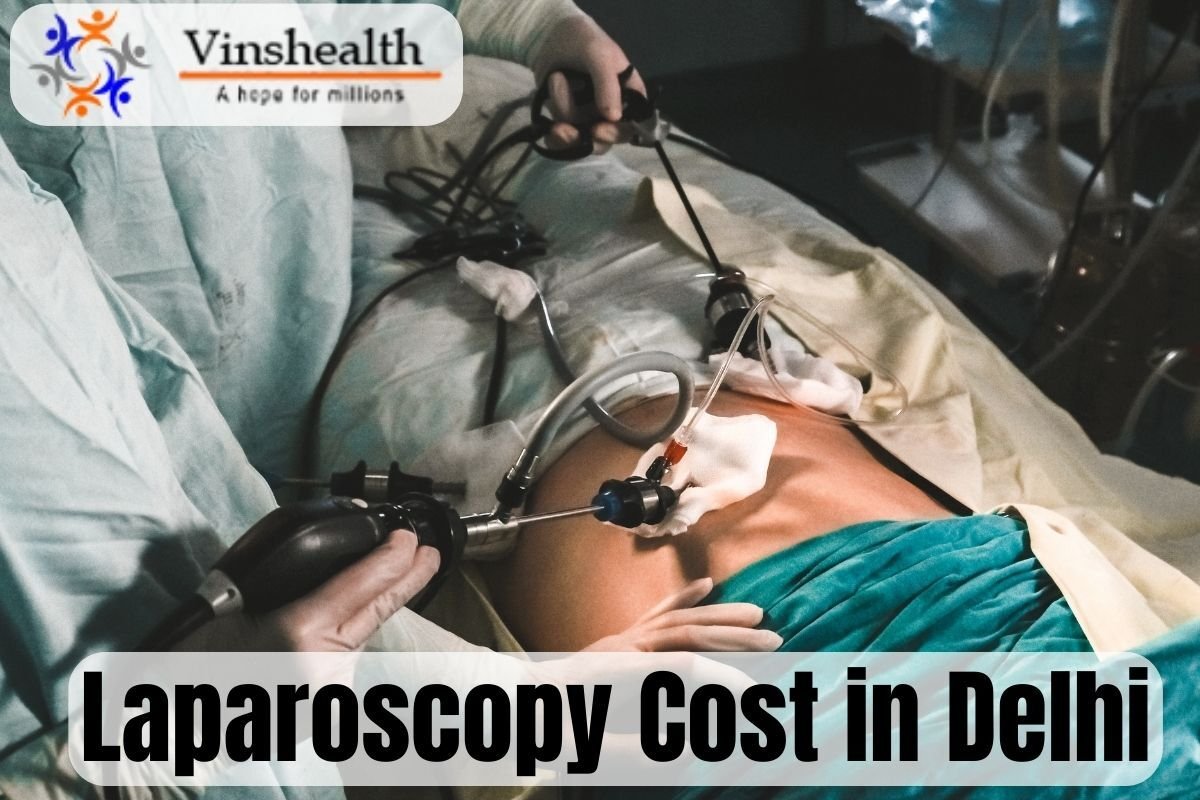 Laparoscopy Cost in Delhi | Success Rate (100%)