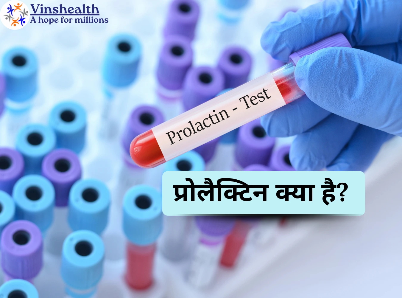 प्रोलैक्टिन  क्या है? जानें इसके लक्षण, कारण और उपचार