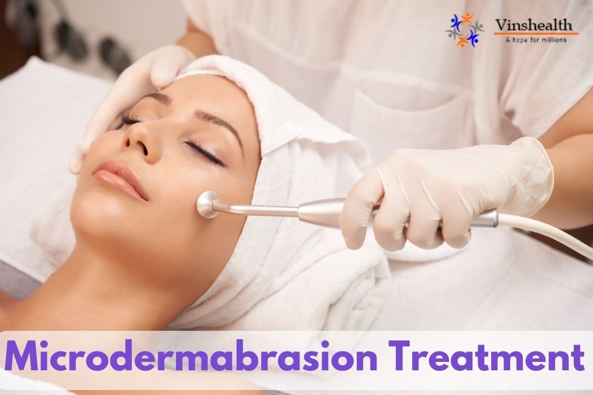 Microdermabrasion: Symptoms, Treatment and Machine