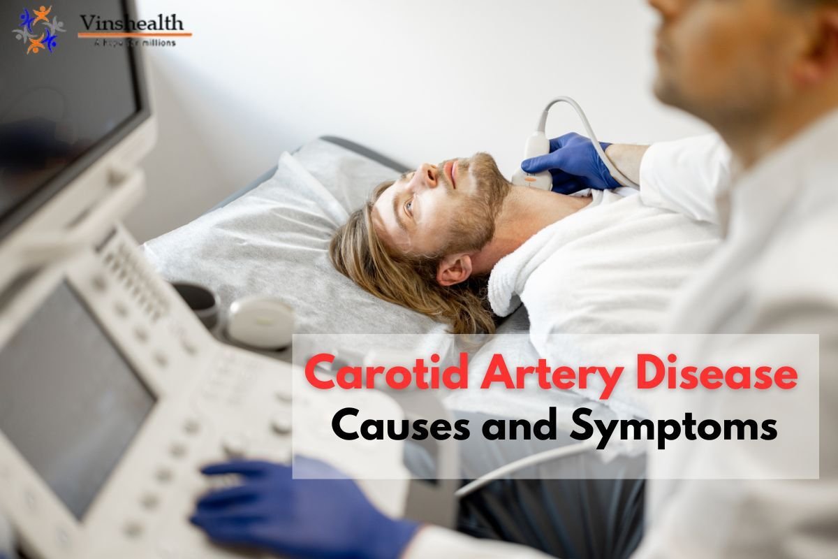 Carotid Artery Disease: Causes and Symptoms