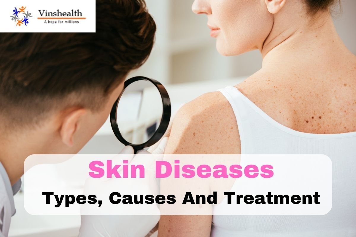 Skin Diseases: Types, Causes And Treatment