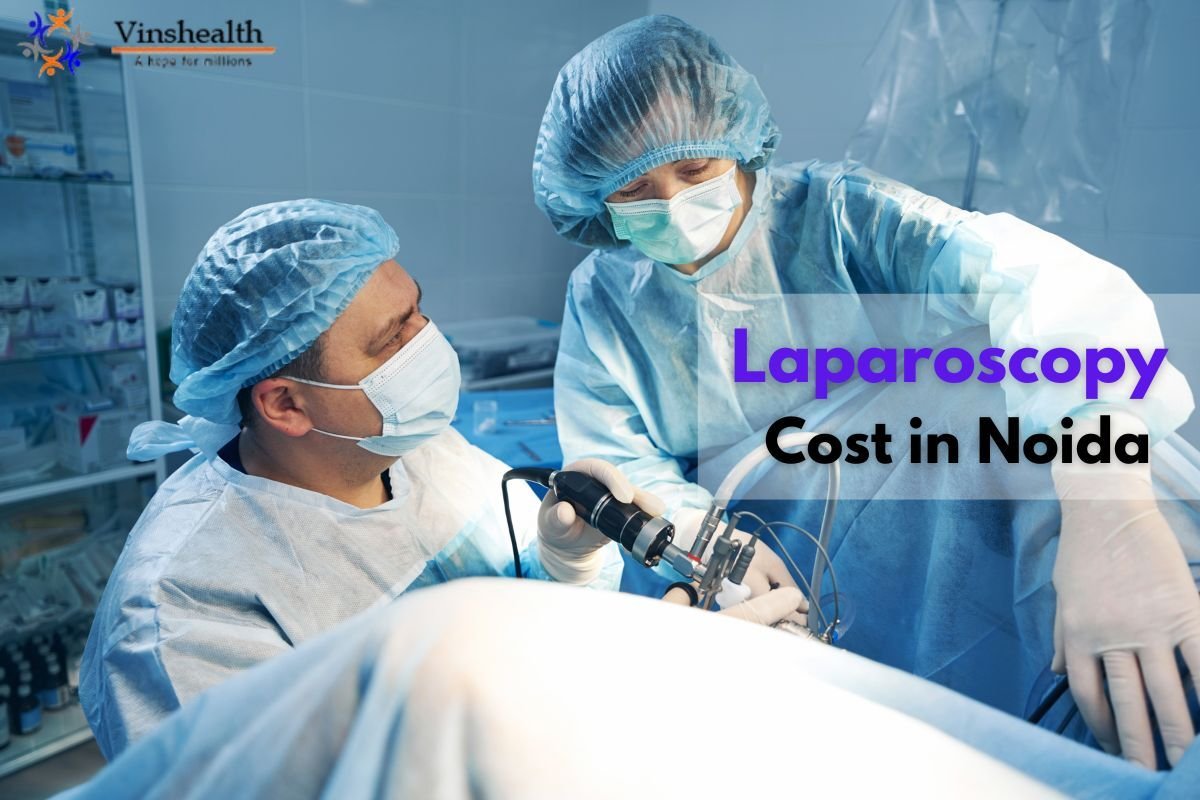 Laparoscopy Cost in Noida - Get Cost Laparoscopy