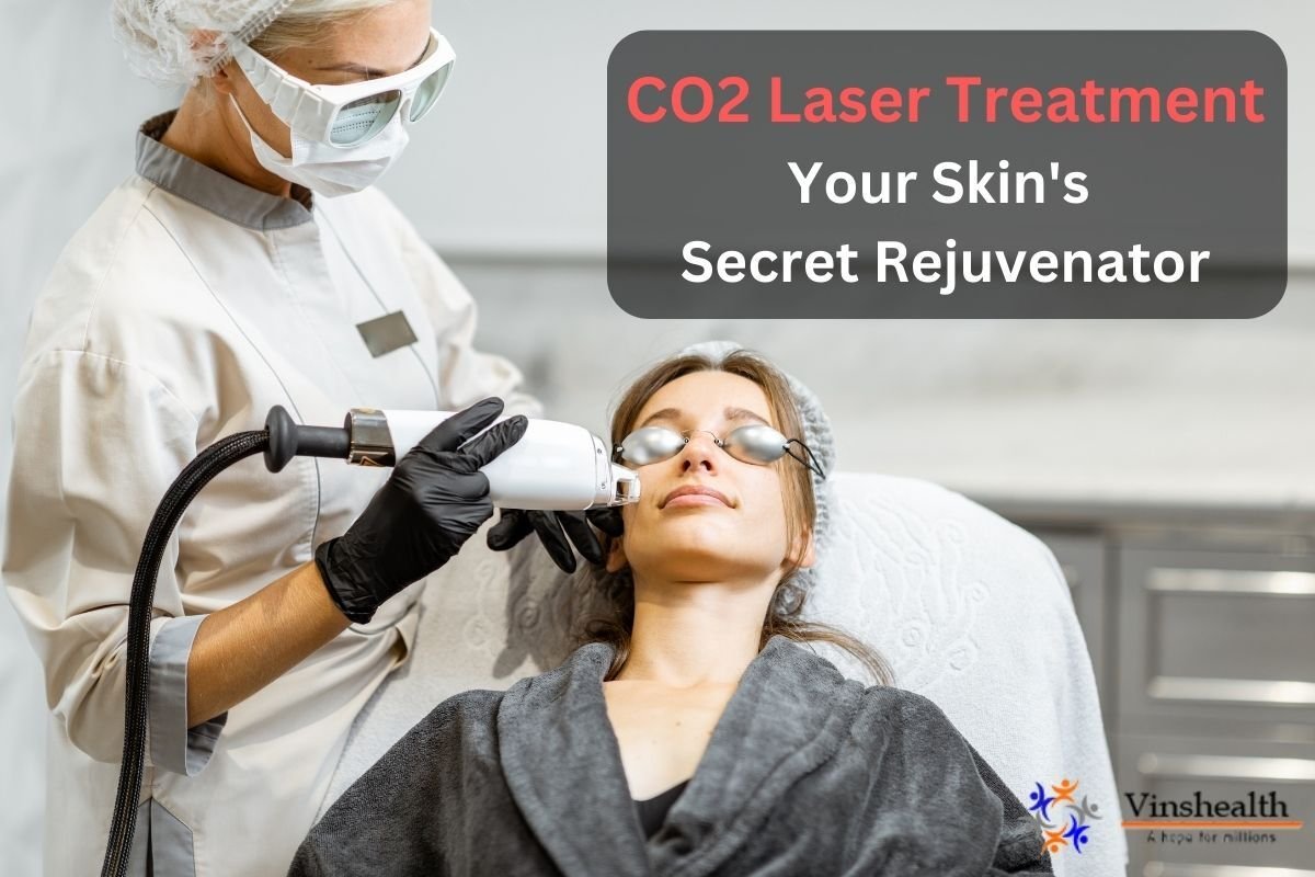 What is CO2 Laser Treatment?