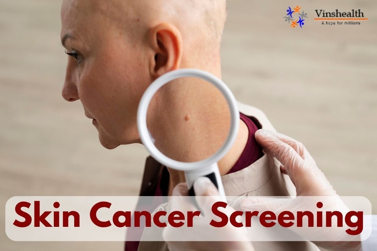 Skin Cancer Screening: Causes, Symptoms and Costs