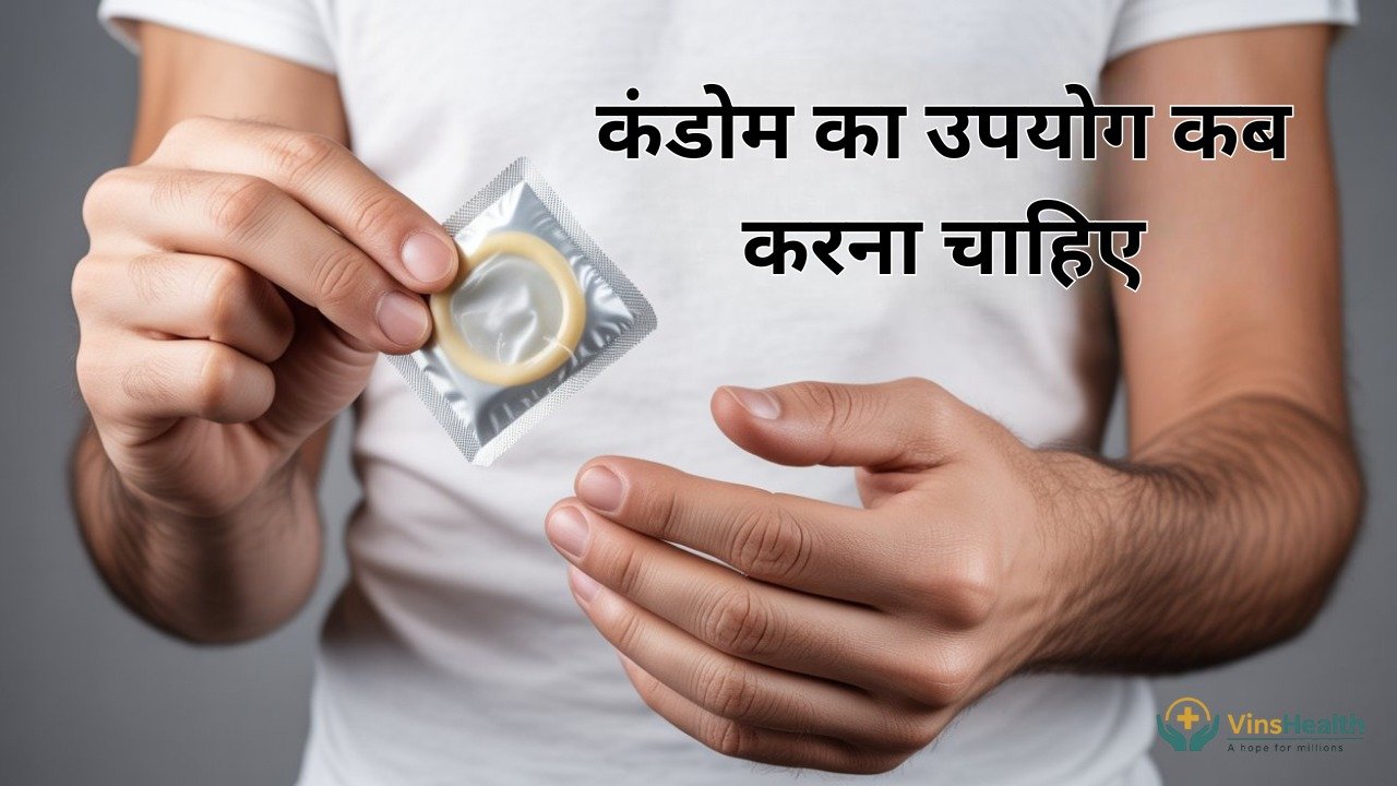 कंडोम का उपयोग कब करना चाहिए? 2025 की पूरी गाइड और टिप्स