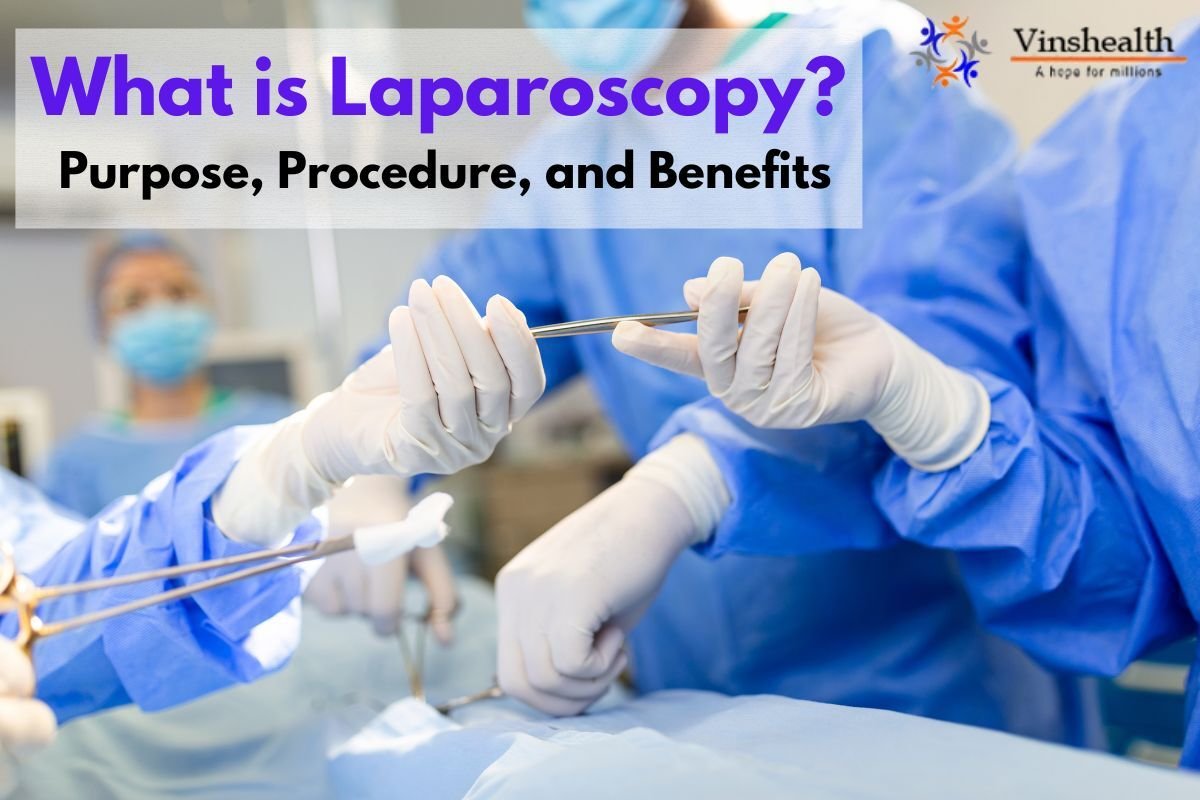 What is Laparoscopy, Purpose, Procedure and Benefits