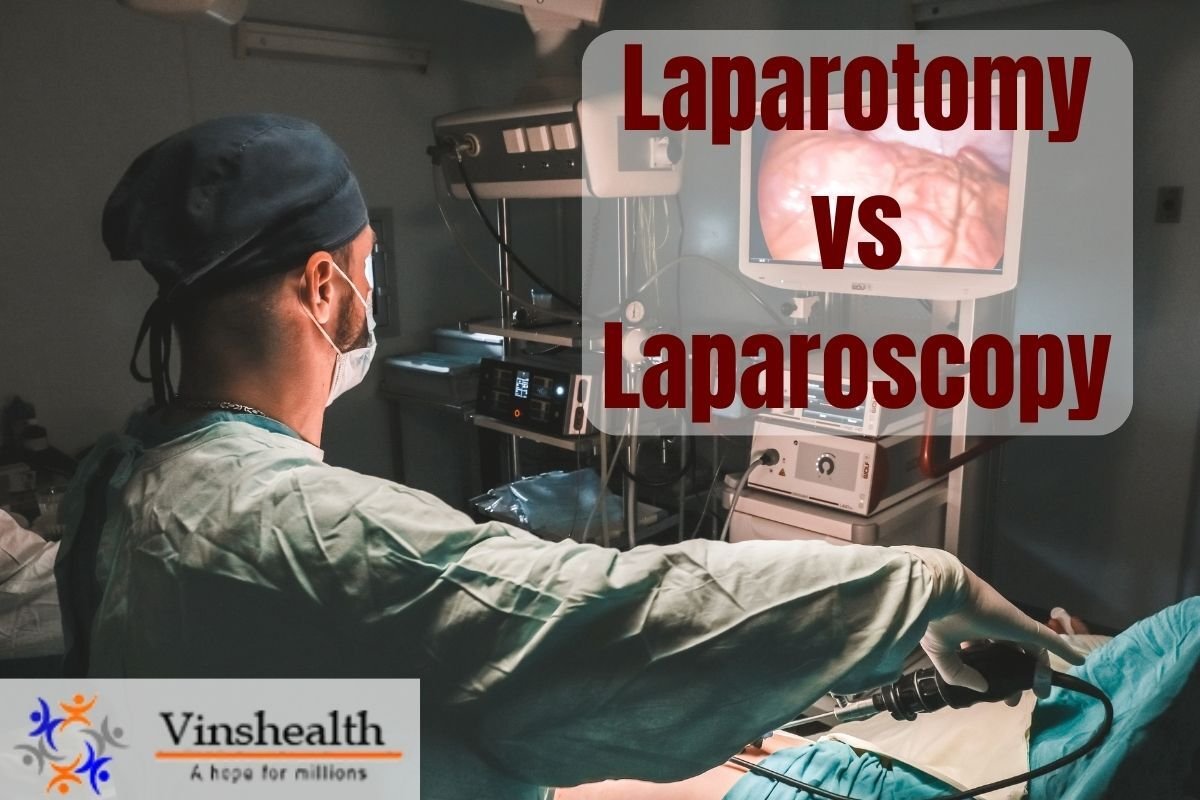 Laparotomy Vs Laparoscopy: What is Laparotomy, Surgical and Advantages