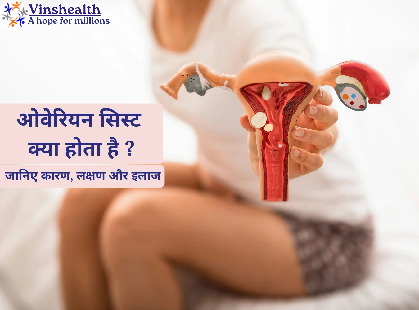 Cysts Meaning in Hindi: ओवेरियन सिस्ट का उपचार